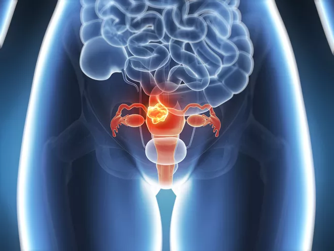 哪个年龄阶段容易卵巢早衰 引起女性提前卵巢早衰的原因