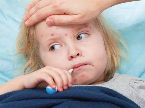 婴儿荨麻疹能用炉甘石吗 宝宝荨麻疹应该怎么护理