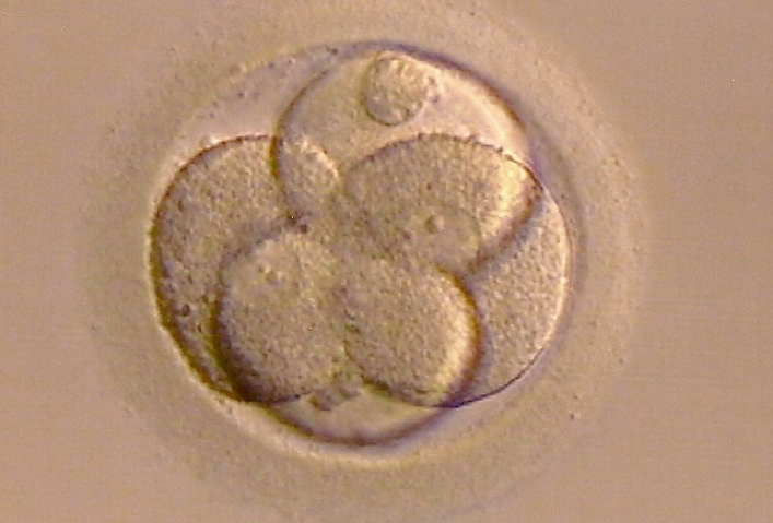 试管婴儿胚胎移植着床需要几天 胚胎移植后受精卵着床有什么感觉