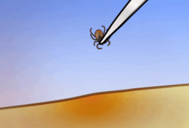 黑腿蜱虫有什么危害 被蜱虫咬了怎么处理