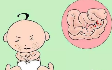 宝宝什么时候需要益生菌 益生菌能和奶粉一起冲吗