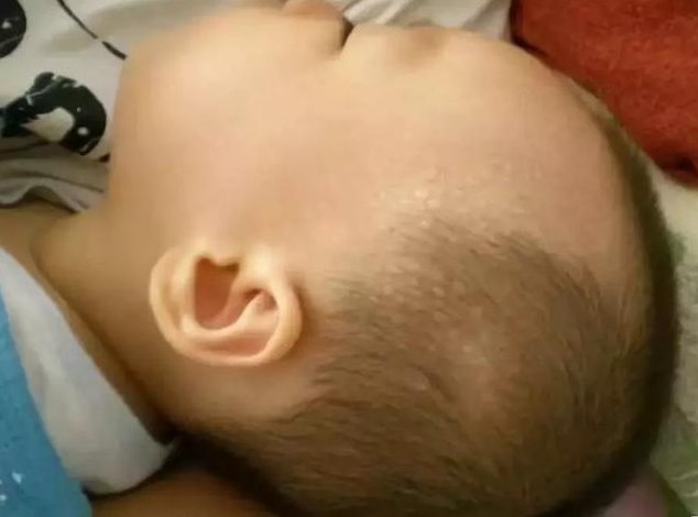 宝宝睡觉出汗是生病了吗 宝宝出汗多是缺什么元素吗