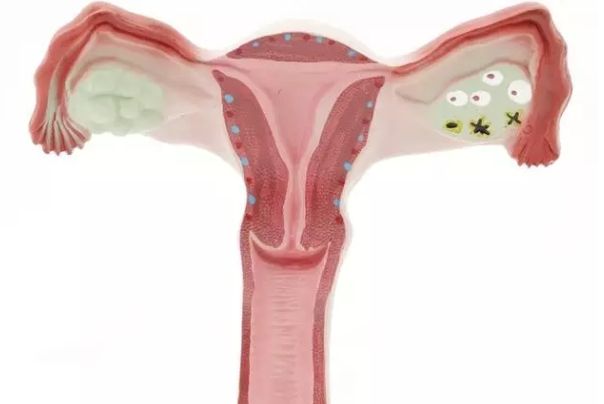 输卵管堵塞症状有哪些 输卵管不通如何预防
