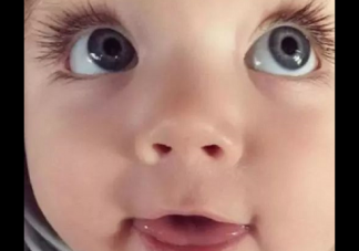 新生儿眼睛普遍比较大是怎么回事 孕妈吃什么宝宝眼睛大