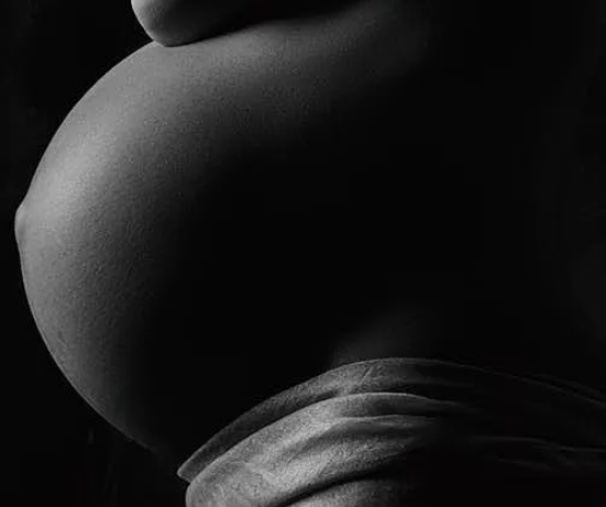 孕妇|孕妇悬垂腹是怎么形成的 悬垂腹的孕妈应该怎么做