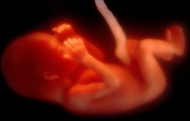 胎停育后要做哪些检查 胎停育发生可能会出现哪些征兆
