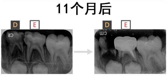 儿童牙齿保健的方法 怎么保护好孩子的牙齿健康