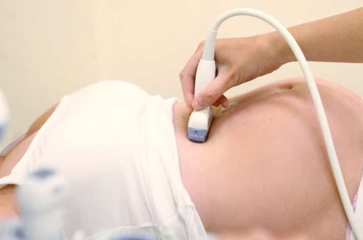 孕晚期|孕晚期子宫肌瘤对母体和胎儿的影响 妊娠合并子宫肌瘤处理方法