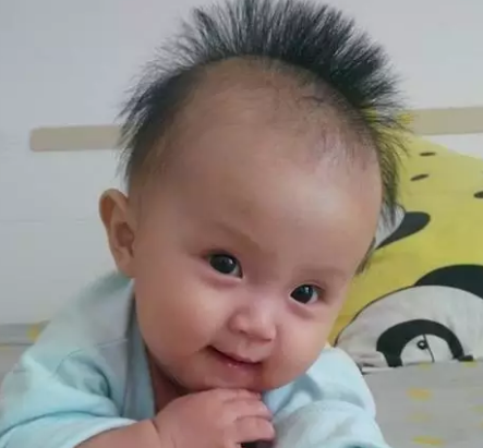 宝宝头发为什么竖着长 孩子头发竖着长怎么办