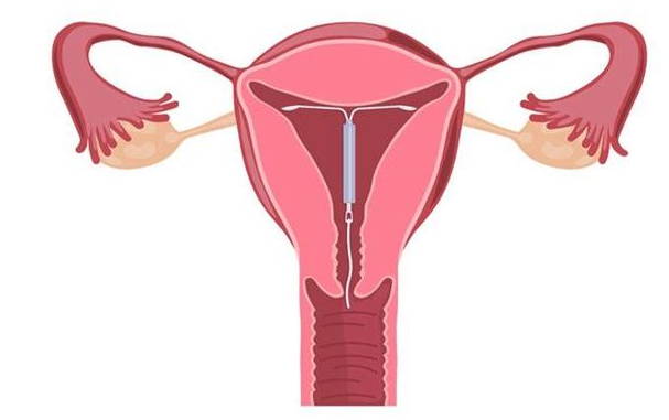 哺乳期同房会怀孕吗 哺乳期过性生活怎么避孕