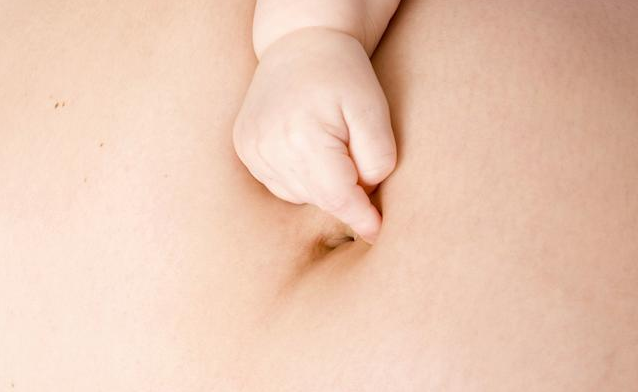 宝宝肚脐鼓包是怎么回事 宝宝脐疝护理方法