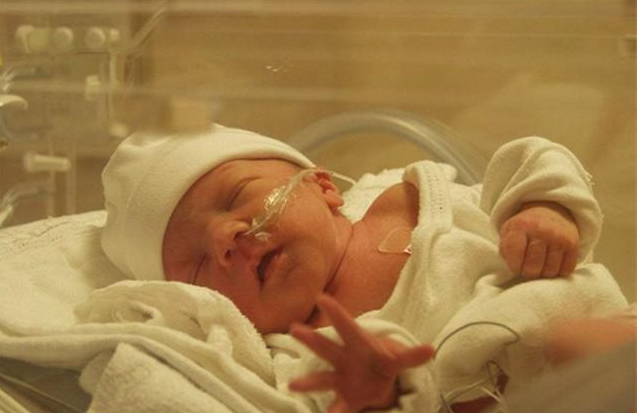 早产儿|早产儿容易出现哪些问题 早产儿如何护理