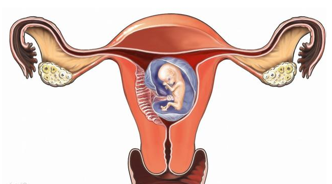 什么是单角子宫 单角子宫怀孕几周最危险