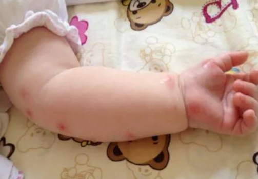 避蚊胺对婴儿有害吗 多大的宝宝可以用避蚊胺驱蚊