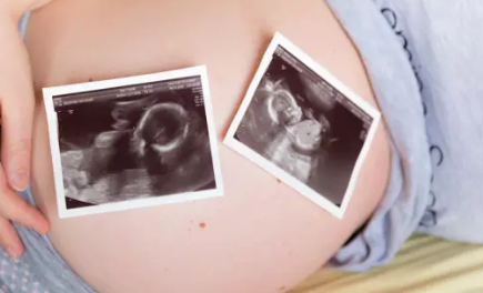 怀双胞胎孕吐会更严重吗 怀双胞胎孕吐严重原因
