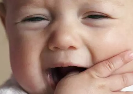 孩子牙龈红肿|孩子牙龈红肿有哪些常见的原因 孩子牙龈红肿怎么办