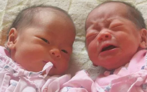 怀双胞胎先兆子痫怎么办 怀双胞胎更容易先兆子痫吗