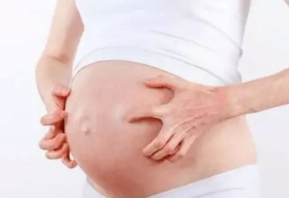 孕产期快到了能提前剖腹产吗 临近分娩要注意什么