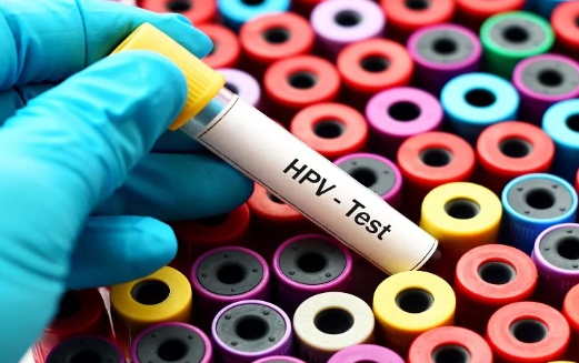 ​备孕检查出HPV阳性怎么办 备孕期间查出hpv感染能怀孕吗