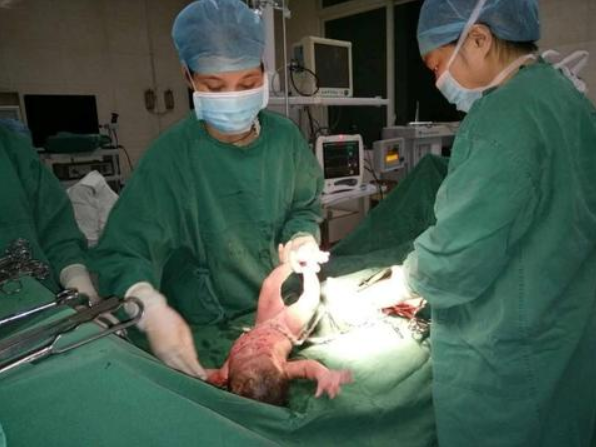 四川长宁震后首个地震宝宝出生 7名新生儿在震后顺利降生