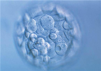 试管婴儿养囊是什么意思 哪些人适合囊胚培养
