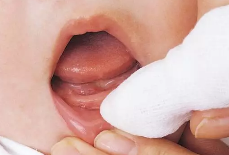 宝宝长牙会引起发烧吗 孩子长牙期间该怎么护理