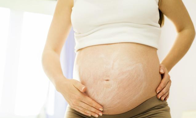 孕妇怎么防止长妊娠纹 妊娠纹医学治疗方法
