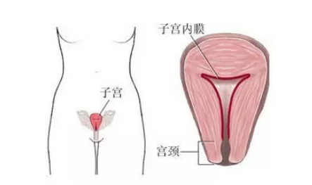 子宫内膜太薄不来月经怎么办 子宫内膜太薄和不来月经有关吗