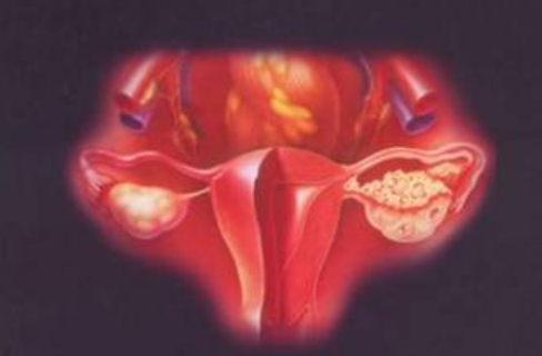 子宫内膜太厚会怎么样 子宫内膜厚度不正常怎么办