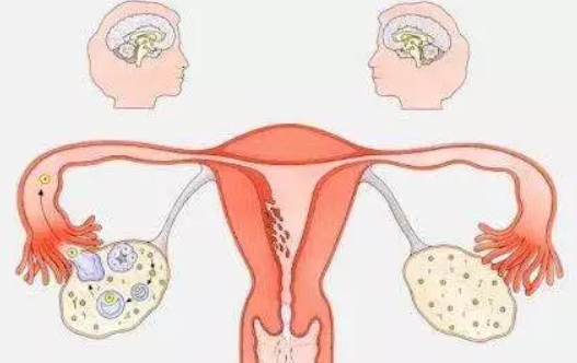子宫内膜太厚不来月经怎么办 子宫内膜太厚影响月经吗