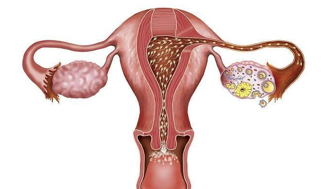 关子宫输卵管造影前要做哪些检查 做了造影就可以疏通输卵管吗