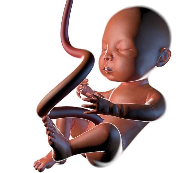 脐带囊肿胎儿能要吗 脐带囊肿对胎儿的影响