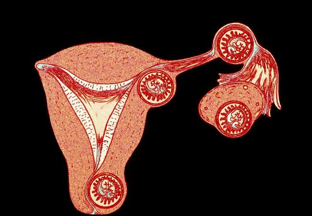 如何及早发现宫外孕 引起宫外孕的病因有哪些