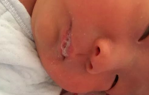宝宝吐泡泡是怎么回事 宝宝吐泡泡就是肺炎吗