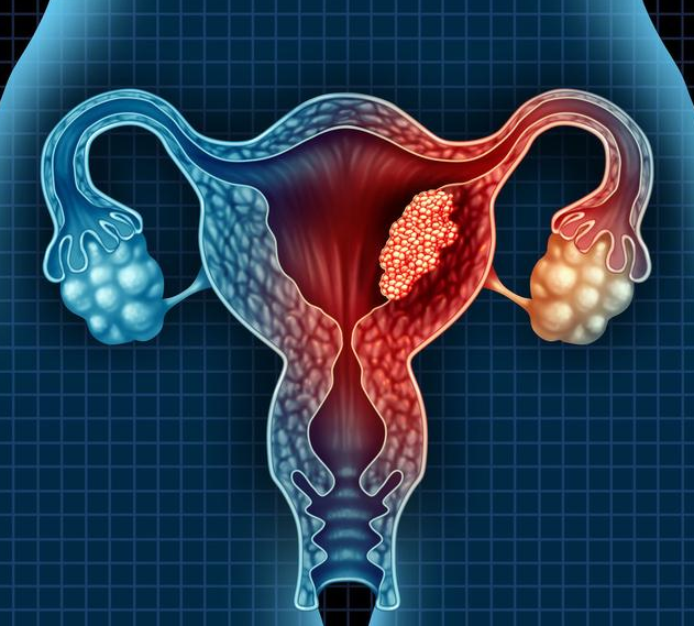 子宫后壁肌瘤会压迫尿道吗 子宫前壁肌瘤和后壁肌瘤有什么区别