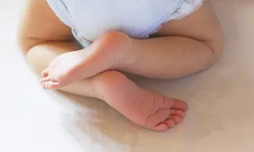 宝宝肛瘘症状有哪些 宝宝肛周囊肿的几个发展期