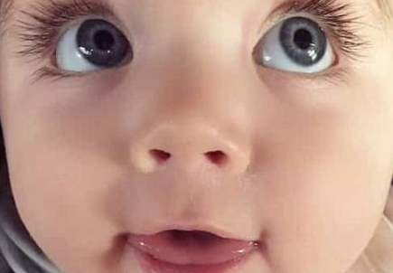 小儿结膜炎的原因是什么 宝宝得了结膜炎会有哪些表现
