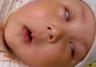 宝宝睡觉翻白眼是什么原因 宝宝睡觉翻白眼怎么办