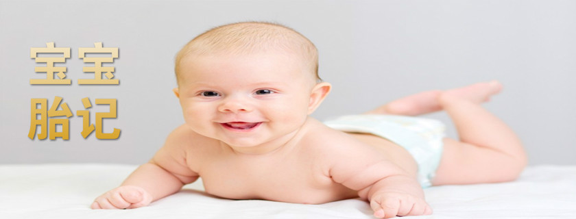 如何避免宝宝长胎记 宝宝长胎记是什么原因