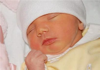 刚出生的宝宝皮肤为什么黄黄的 刚出生宝宝皮肤黄是新生儿黄疸吗