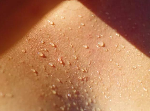 身体出汗多是在排毒吗 异常出汗可能是疾病的征兆