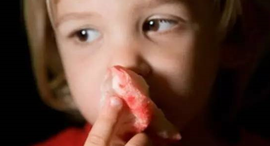 秋季孩子流鼻血是什么原因 秋季孩子流鼻血吃什么好