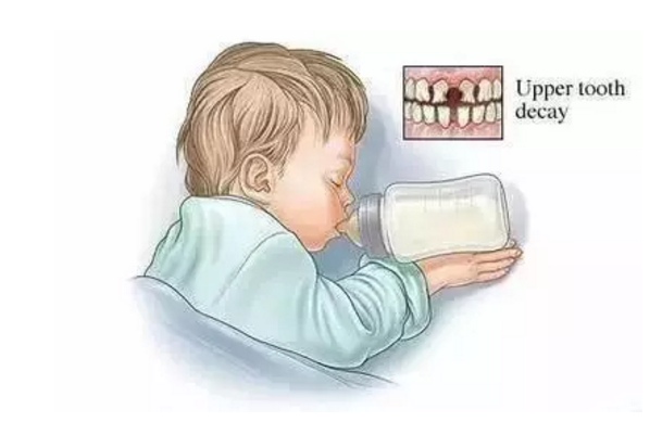 宝宝吃奶瓶要吃多久比较好 孩子长期的使用奶瓶有什么影响