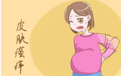 怀孕期间肚皮发痒是怎么回事 怀孕期间肚皮发痒怎么办