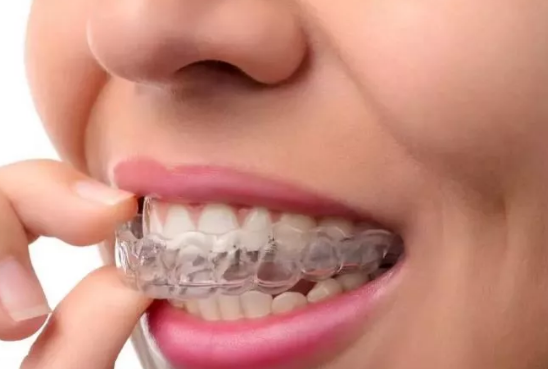 牙齿矫正期间不能吃哪些东西 牙齿矫正期要注意什么
