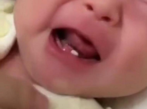 女婴出生长两颗牙怎么回事 出生三天就有牙齿正常吗