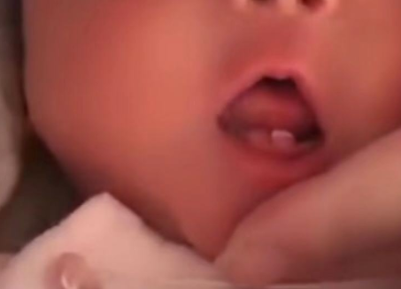女婴出生长两颗牙怎么回事 出生三天就有牙齿正常吗