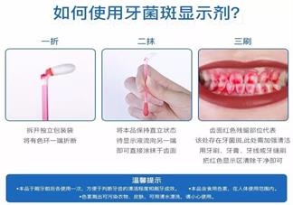 菌斑指示剂的使用方法是什么 怎么使用菌斑指示剂来看牙菌斑