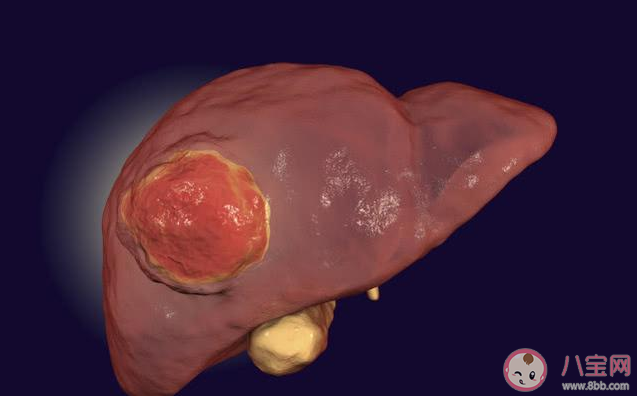 乙肝会转化为肝癌吗 肝癌和什么因素有关