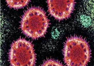 新型冠状病毒肺炎被纳入法定传染病是什么意思 法定传染病通常具备什么特点
